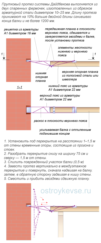 Установка прутковых протезов